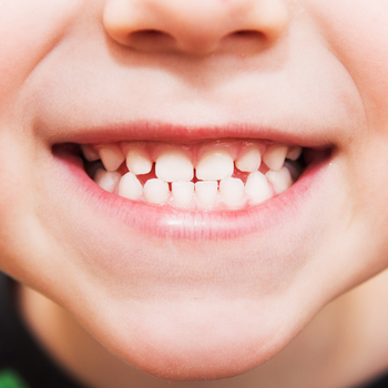 Thumbnail of topic : Paediatric Dentistry in Nal Stop | Dr. Vighnesh and Manisha Dixit